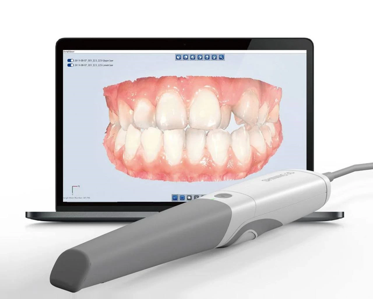 Máy Scan Shining 3D AORALSCAN 3