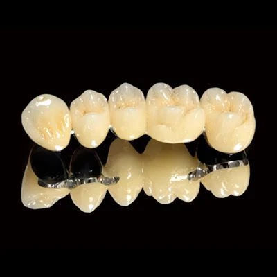 Răng sứ kim loại