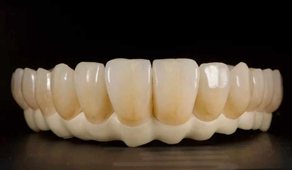 Răng sứ Nacera Q3