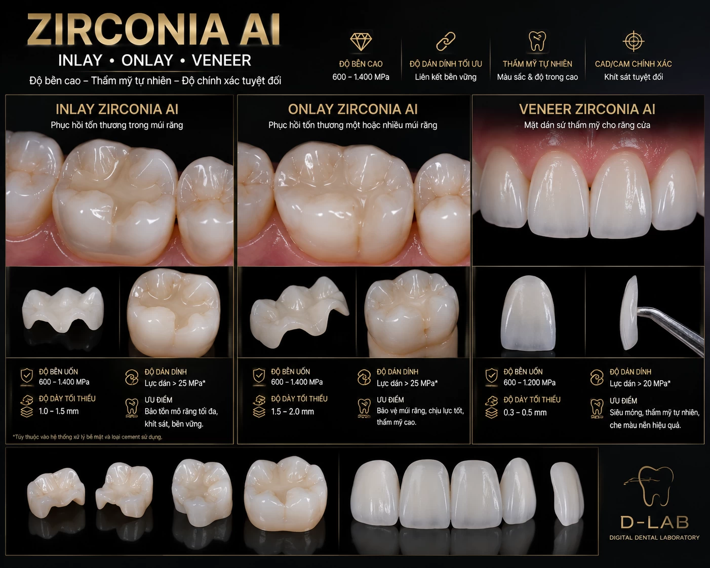 Mặt dán Inlay,Onlay,Veneer Zirconia AI