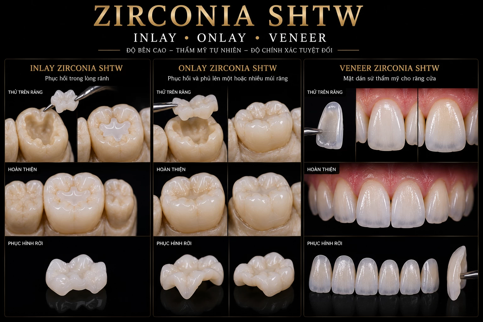 Mặt dán Inlay,Onlay,Veneer Zirconia SHTW